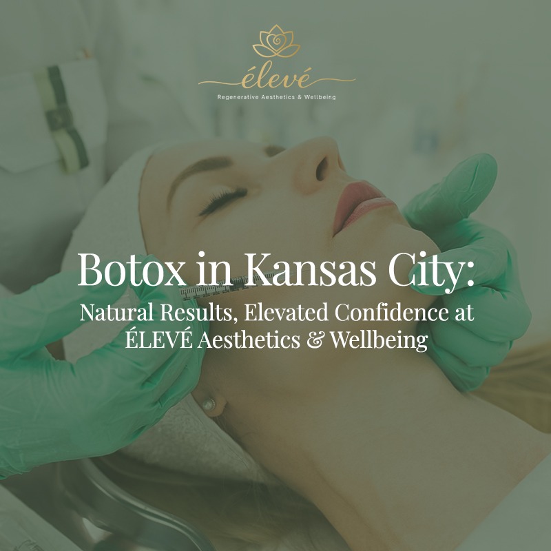Botox in Kansas City: Natural Results, Elevated Confidence at ÉLEVÉ Aesthetics & Wellbeing